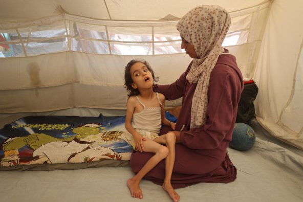 ガザ中部にあるブレイジ難民キャンプで暮らす、重度の栄養不良に苦しむ7歳の女の子と母親（パレスチナ、2025年7月28日撮影）