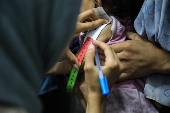 ガザ地区にある栄養治療センターで、上腕計測メジャーを用いた栄養状態の検査を受ける子ども（パレスチナ、2025年7月28日撮影）