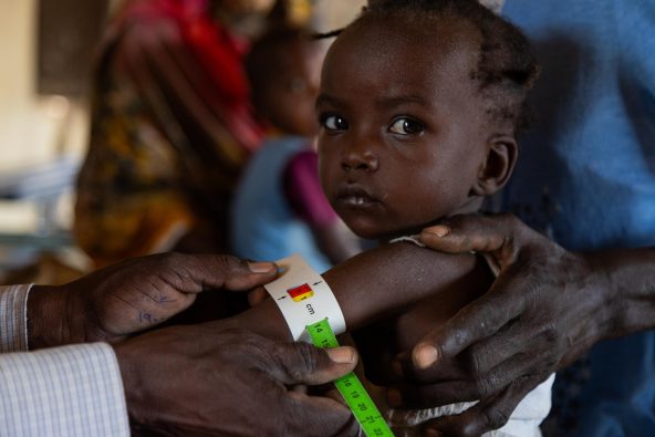 ハルツーム州ジャバラ・アウリアにあるユニセフが支援する診療所で、上腕計測メジャーを使った栄養状態の検査を受け、赤色=重度栄養不良と示された子ども(スーダン、2025年8月3日撮影)