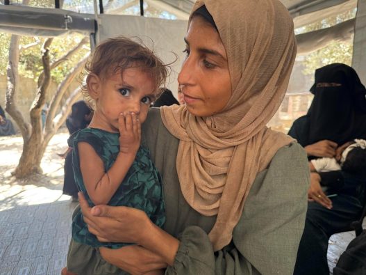 1歳のヌールちゃんと母親。ヌールちゃんは体重が5キロしかなく、重度の栄養不良に陥っている(パレスチナ、2025年8月20日撮影)