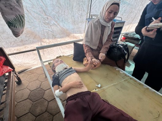 ガザ市のアル・アハリ病院のベッドに横たわる10歳の男の子。ガザ市の北に位置するジャバリアで家族と一緒に暮らしていたが、戦車の侵入と砲撃の勃発により深刻なけがを負った(パレスチナ、2025年8月26日撮影)