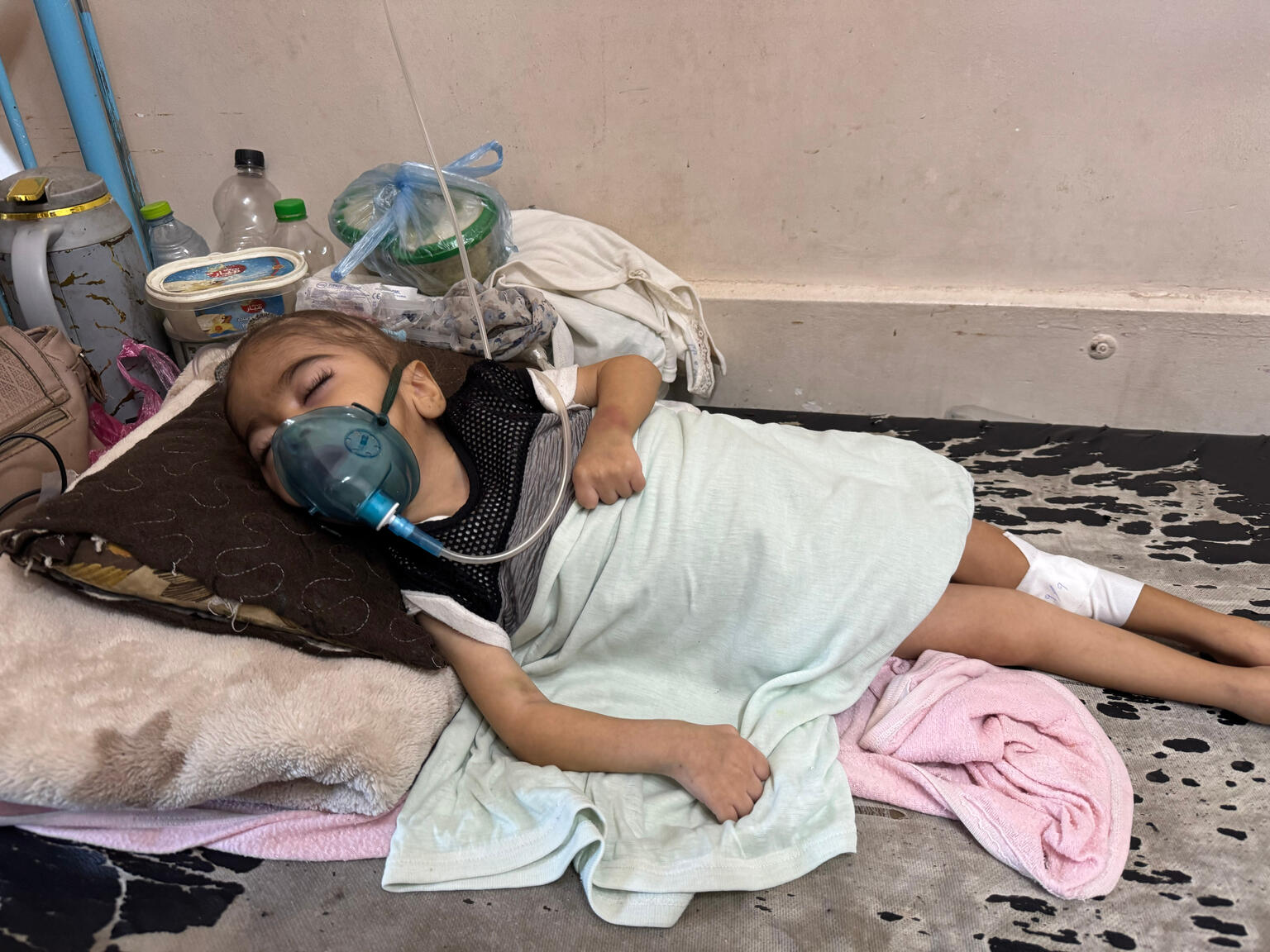 ガザ地区南部にある病院で、重度の急性栄養不良のために治療を受ける1歳の女の子（パレスチナ、2025年10月1日撮影）