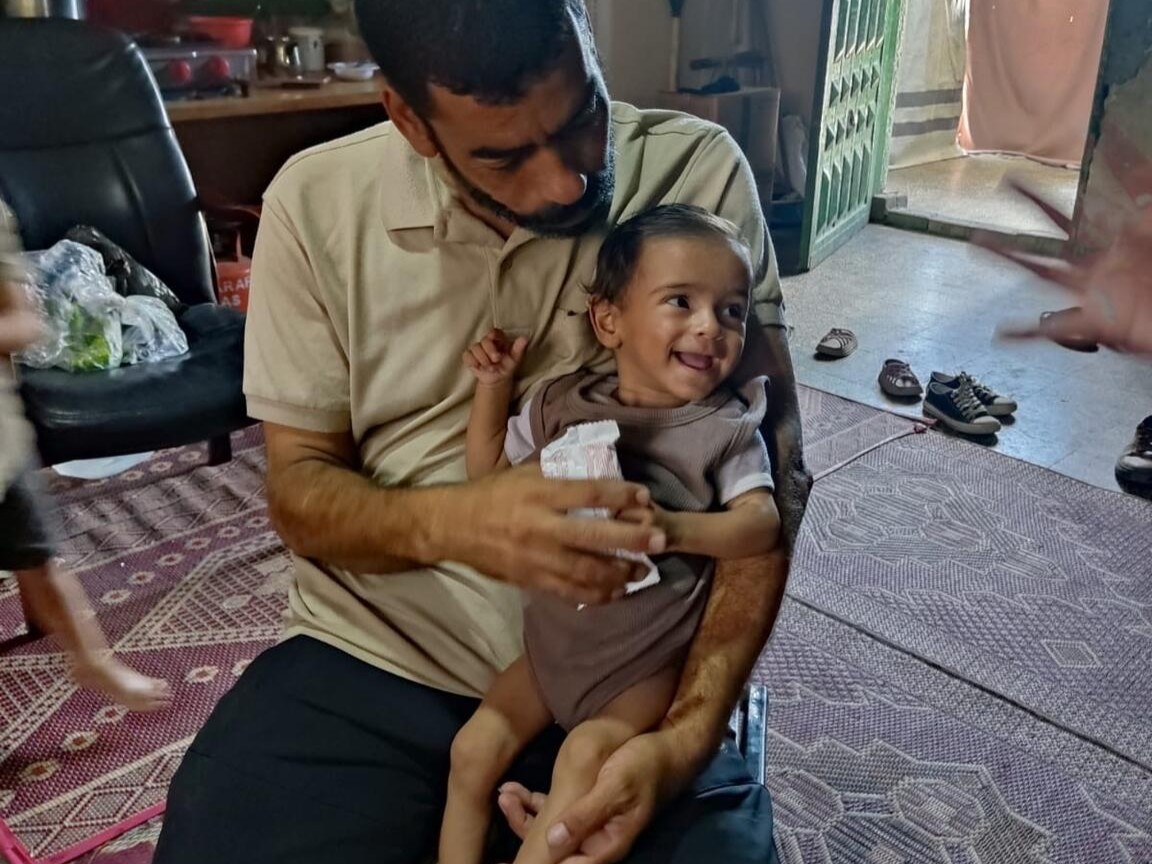 栄養治療を受けて回復し、叔父に抱っこされて笑顔を見せるオデイちゃん（パレスチナ、2025年7月24日撮影）