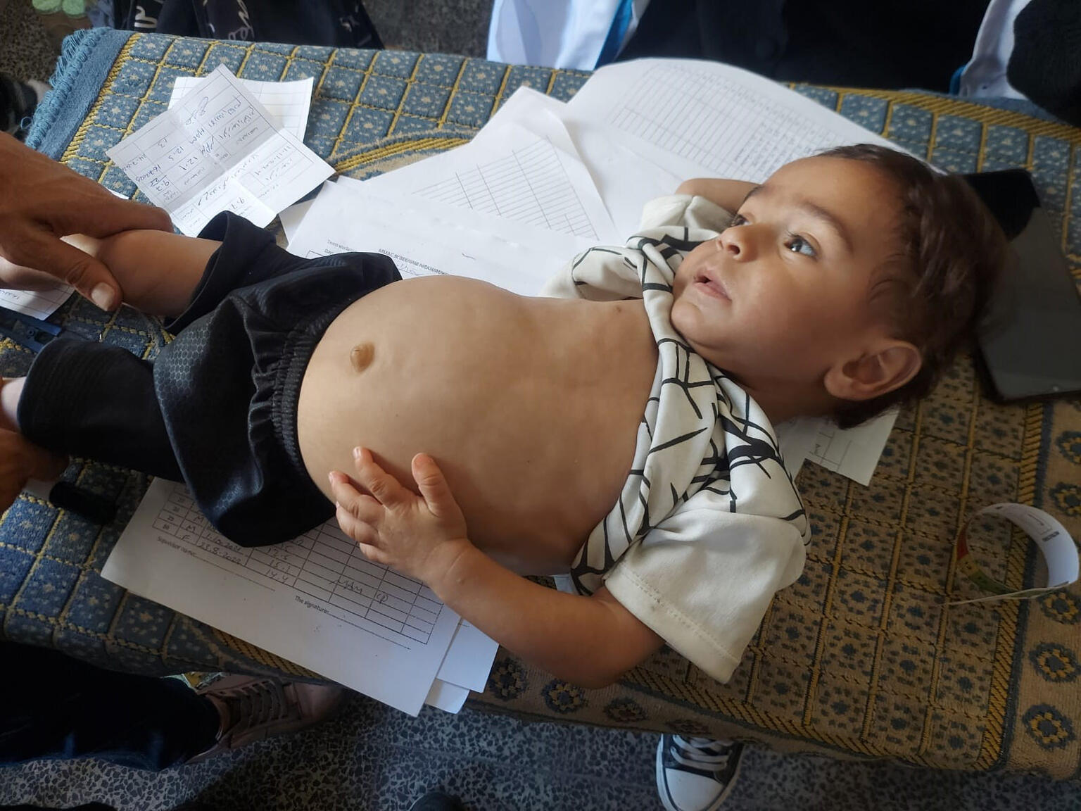 ガザ地区でユニセフによる栄養治療および支援サービスを10日間受けた結果、ふっくらとした体つきになり、発達も改善したオデイちゃん（パレスチナ、2025年7月24日撮影）