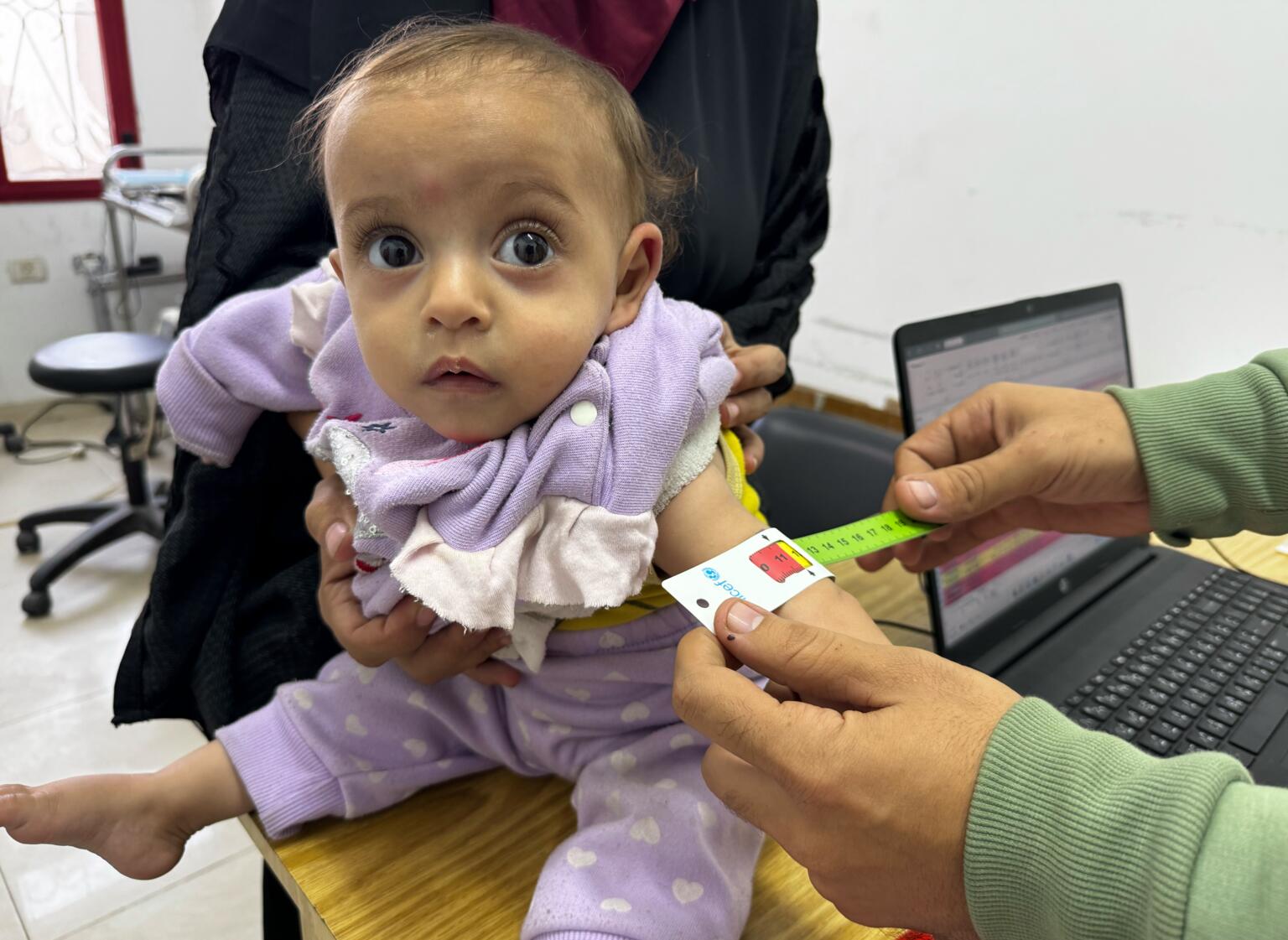 ガザ市のユニセフが支援する栄養治療拠点で、上腕計測メジャーを使った栄養状態の検査を受ける生後10カ月のファラスティーンちゃん（パレスチナ、2025年11月26日撮影）