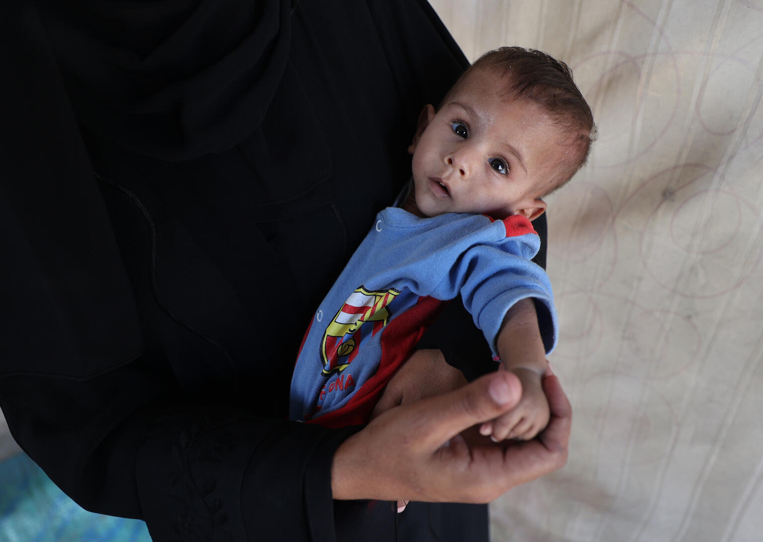 ガザ南部マワシの仮設テントで暮らす2歳のアリちゃん。栄養不良に苦しんでおり、体重はわずか3キログラムである(パレスチナ、2025年10月7日撮影)