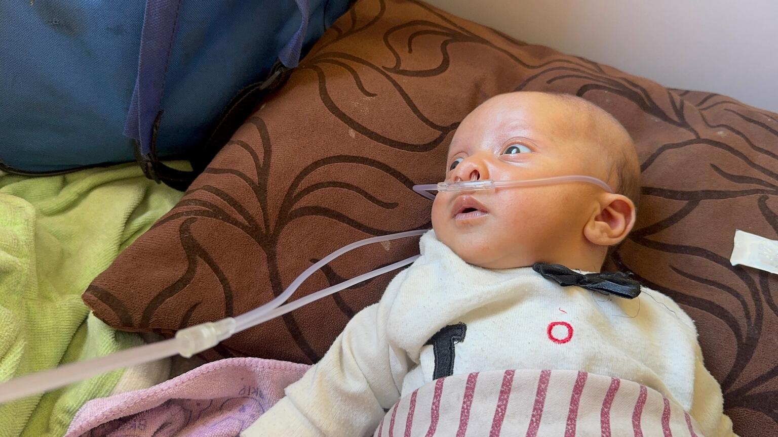 ガザ南部にある病院で、酸素治療を受ける子ども。ガザでは子どもたちの間で呼吸器疾患が広がっているが、その主な原因は食料などの不足による栄養不良と考えられる(パレスチナ、2025年10月1日撮影)