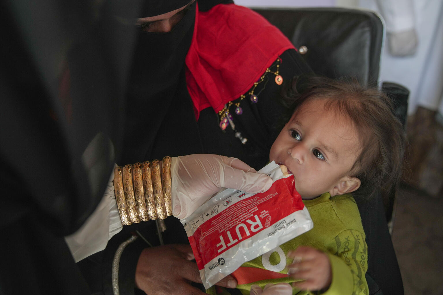 カブールにあるユニセフ支援のデイケアセンターで、重度の栄養不良と診断された生後８カ月のバフラムちゃん。すぐに食べられる栄養治療食（RUTF）を提供され、回復に向かっている（アフガニスタン、2025年10月23日撮影）