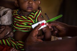 Mothers bring their babies and young children to be screened for malnutrition at the community health post. Across eastern and southern Africa, millions of children are struggling to cope with food insecurity, lack of water and disease. In Ethiopia, after two years of erratic rainfall and drought, one of the most powerful El Niño weather events for 50 years is wreaking havoc on lives and livelihoods. The Government of Ethiopia has been leading the humanitarian response but needs are vast - near on six million children in Ethiopia are in need of food assistance. Health systems are in place with the Government of Ethiopia and UNICEF working together to make sure health professionals are well trained and that supplies like emergency therapeutic food and milk are well stocked In this kabele, the fear is that come March families will have sold the few assets they have left. They will have literally nothing. It is therefore vital that supplementary feeding programmes  led by the UN World Food Programme (WFP) are scaled up to ensure that moderately malnourished children (and their families) are receiving food when stocks are low or non-existent in homes. Without focus on supplementary feeding, we will start to see more children becoming severely acutely malnourished children, requiring more attention at health centres and hospitals as opposed to at the community level  and of course more funds. Arago Nemano Kabele, Shalla Woreda, West Arsi Zone. © UNICEF Ethiopia/2016/Ayene