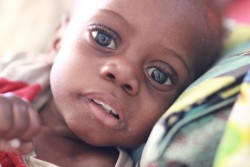 ツハフェニくん（生後18カ月）は重度の急性栄養不良で苦しんでいる。