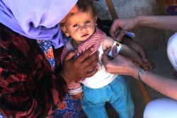 アレッポ市西部のマジバル地域で家族とテント生活をするファティマちゃん（1歳）。ユニセフの保健・栄養チームの診察を受け重度の栄養不良と診断された。（2016年9月13日撮影）