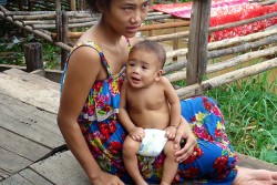 母親の膝に座る1歳3カ月の赤ちゃん。重度の急性栄養不良状態だったが、栄養治療ケアを受けたことで回復に向かっている。