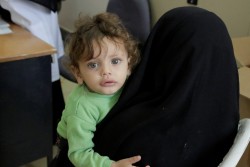 イエメンの病院で、栄養状態を調べる検査を受けるため母親と待つ女の子（2016年5月6日撮影）