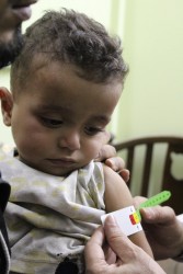 栄養不良の検査を受ける子ども。 (東グータ)2017年10月30日撮影