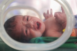 治療を受ける未熟児で生まれた赤ちゃん。(2018年1月8日撮影)