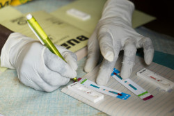 採取した血液で、HIV検査とマラリア検査がおこなわれている（ウガンダ）