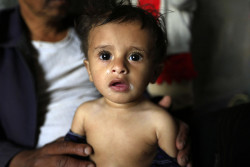 Yemeni baby Yahya Hamoud Ali Al Huzef, 9 months suffering from malnutrition is with his family in his house in the outskirts of the capital Sanaa on October 30, 2018. (Release obtained) With ongoing and unending conflict in Yemen, humanitarian situation continues to deteriorate across the country. There are over 400,000 severely malnourished children in need urgent lifesaving assistance in Yemen.  The country is on the brink of famine and children’s chances of survival are becoming slimmer by the day.  UNICEF are working with partners around-the clock to save children suffering from malnutrition and disease.  We are currently working to reach: •	275,000 malnourished children with critical life-saving supplies and care •	Over 5 million people with safe and clean water to stop the spread of life-threatening diseases •	Nearly 1 million children with vaccines and healthcare  •	9 million people with emergency cash assistance to help families buy basic commodities so they can survive