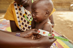 At Gabat OTP in Aweil, South Sudan, eight-month-old  Akot Anjue is screened for malnutrition and found severely acute malnourished. Anyang says the food situation is difficult. “I am not able to get food and I wasn't even able to get porridge when I delivered my child.” “Right now, to get my child porridge I have to go to the market to earn a living however I have not been able to do this recently because of my child's illness and as a result there has been no means for acquiring food for my children recently” “He is in poor health because there is no food available however if food like RUTF is available to him then it is possible for him to eat well and for his health to improve” “As long as there is food for children then all will be well and the only thing that will remain is medicine for them” “Previously we used to work and do farming but right now things are difficult because there are no seeds and there is not land available for farming” Akot is now enrolled in one of UNICEF’s outpatient therapeutic programmes in Aweil, South Sudan. Per 2018, UNICEF is supporting 858 outpatient therapeutic programme (OTP) centres across South Sudan. In these centres, children are screened for malnutrition, checked for some of the most common diseases such as malaria, treatment for malnutrition and underlying diseases initiated, and regular check-ups during the treatment period conducted. The actual treatment of malnutrition is happening in the children’s home. The caregivers are provided with therapeutic food for one week at the time. Every week, the child is brought back to the OTP for monitoring of progress and the caregiver will pick up supplies for the coming week. As of 2018, the recovery rate in the OTPs were 88%, meaning if UNICEF can access the children and we have sufficient funding, children suffering from acute malnutrition has a high chance of being saved. The OTPs also provide mothers and other caregivers with guidance on proper nutriti