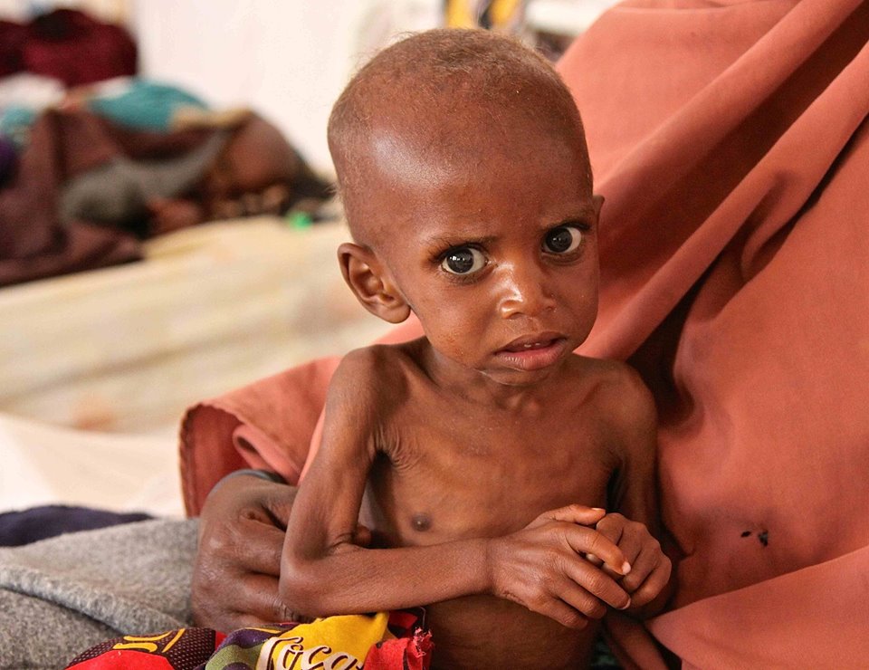 エボラ出血熱流行の危険因子