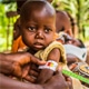 アフリカ栄養危機緊急募金