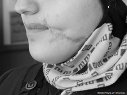 アレッポの西部に住むサルマさん、16歳