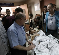 空爆で重傷を負ったモハメドくん。(8月撮影)