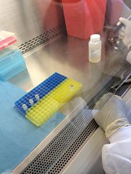 看護師が慎重に検体を試験管に入れる様子。