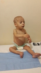 ハレドくん（支援前）