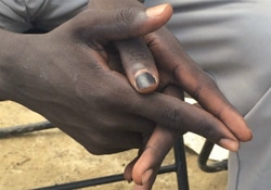 武装グループから逃げ出し、国連施設の避難所に身を寄せるデイビッドくん（16歳）。