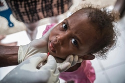 予防接種とビタミンＡの投与を受ける子ども。（バヌアツ/サイクロン）