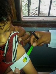 栄養状態の検査を受ける女の子。