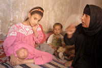 写真：クラスター爆弾の小型爆弾により片足を失った12歳の少女