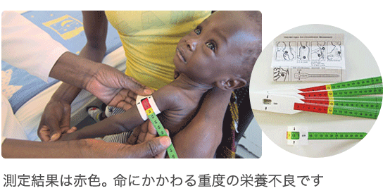 測定結果は赤色。 命にかかわる重度の栄養不良です