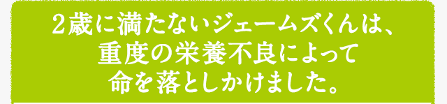 2歳に満たないジェームズくんは、重度の栄養不良によって命を落としかけました。