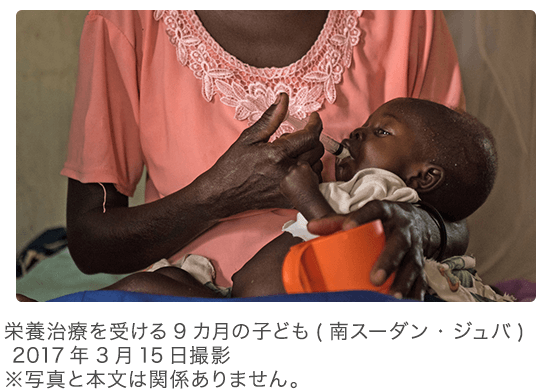 栄養治療を受ける9カ月の子ども