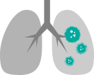 イラスト：肺炎