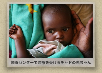 栄養センターで治療を受けるチャドの赤ちゃん