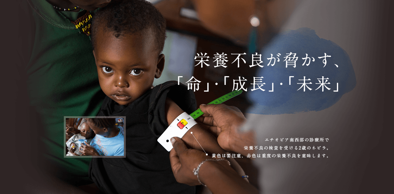 栄養不良が脅かす、「命」・「成長」・「未来」