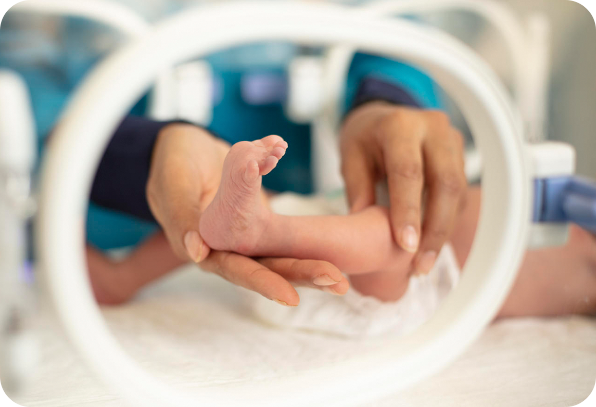 紛争を逃れて避難生活を送る中、早産で生まれたハッサン