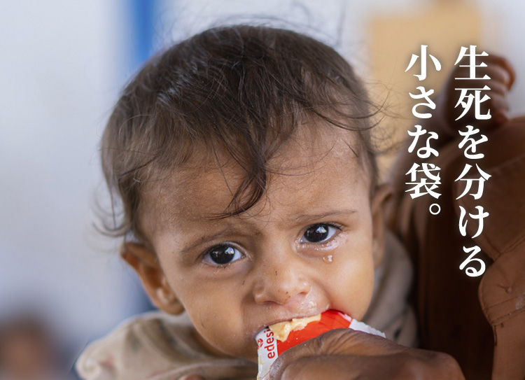 生死を分ける小さな袋。