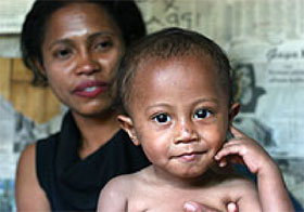 フィリーノくん、2歳。 生まれてからずっと病気を繰り返し、栄養不良に苦しんでいます。 