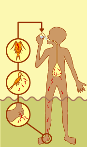 メジナ虫病の経緯